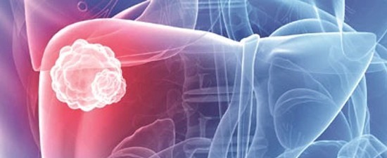 Tumor Markers